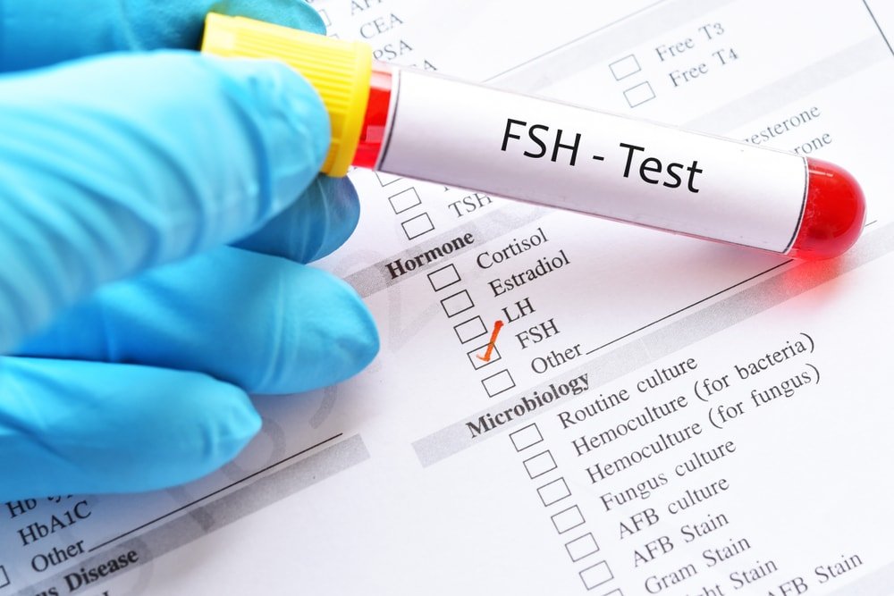 Follicle Stimulating Hormone FSH Levels Test Archives India CSR