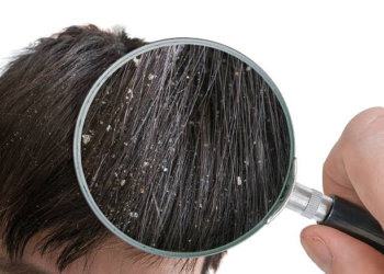 10 Hair Wash Tips to Reduce Dandruff