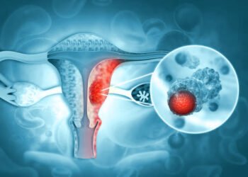 What is Cervical Cancer and how to prevent it?