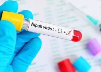 Nipah virus