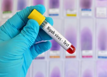Nipah virus affect humans and animals