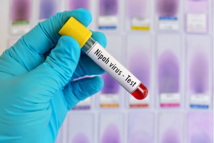 Nipah virus affect humans and animals