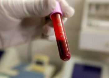 In a bold move aimed at challenging the age-old taboos surrounding menstrual blood, a groundbreaking initiative has been launched to empower women and promote menstrual hygiene awareness.