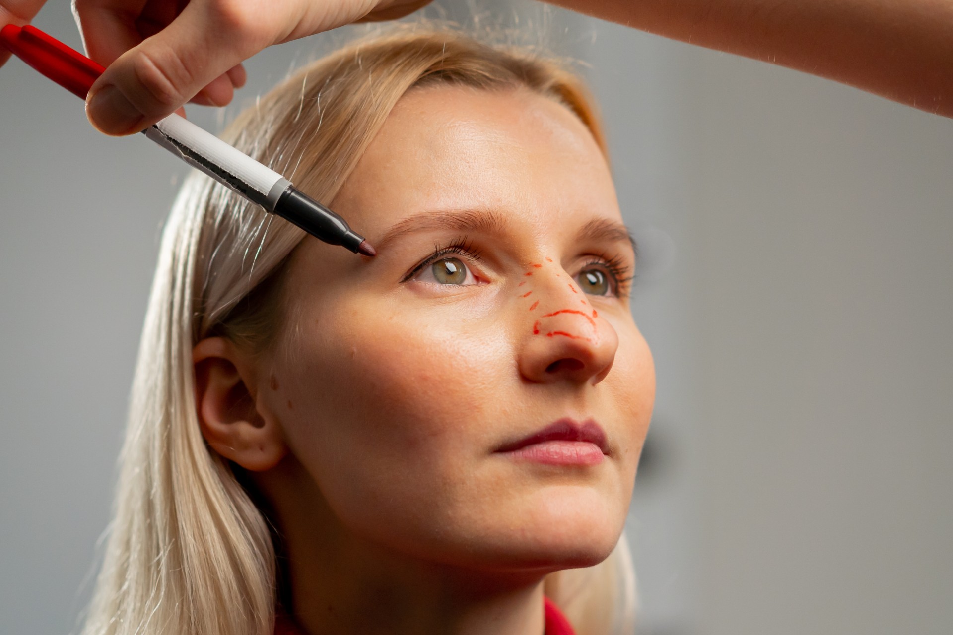 Rhinoplasty