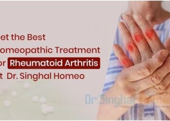 Homeopathic Treatment for Rheumatoid Arthritis