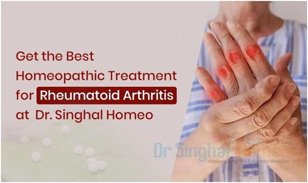 Homeopathic Treatment for Rheumatoid Arthritis