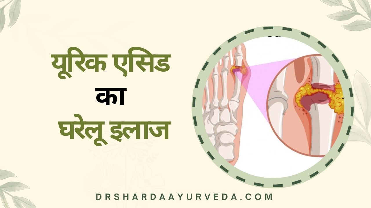 यूरिक एसिड का घरेलू इलाज