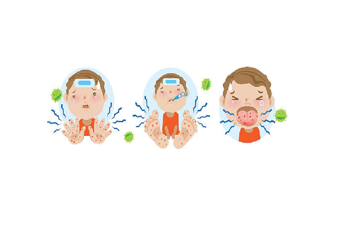 Conquer Hand, Foot and Mouth Disease: A Parent's Toolkit 1 Conquer Hand, Foot and Mouth Disease
