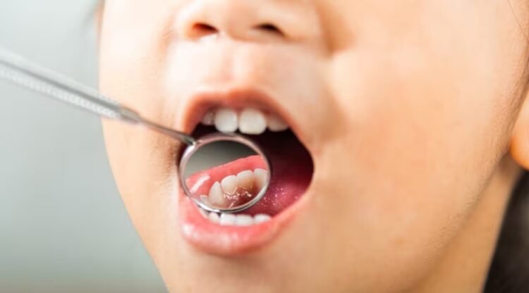 Oral Health in India