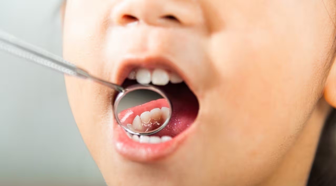 Oral Health in India