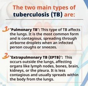 Towards a TB-Free India: World Tuberculosis Day 2025 Highlights Ambitious Progress 3 Types of Tuberculosis