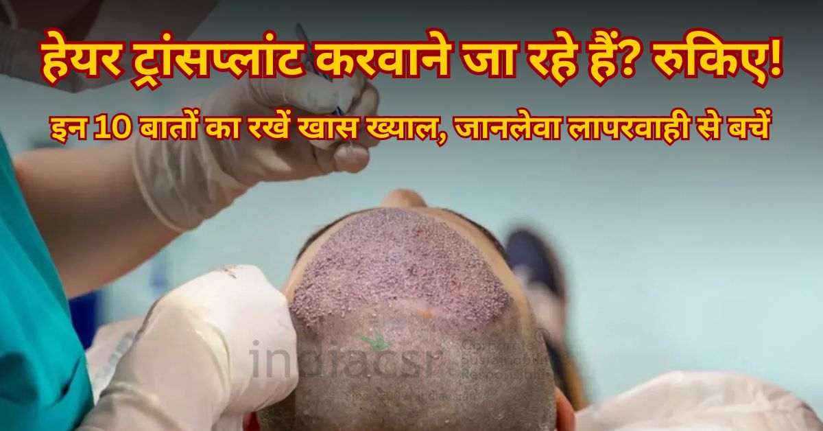 हेयर ट्रांसप्लांट करवाने जा रहे हैं? रुकिए! इन 10 बातों का रखें खास ख्याल, जानलेवा लापरवाही से बचें