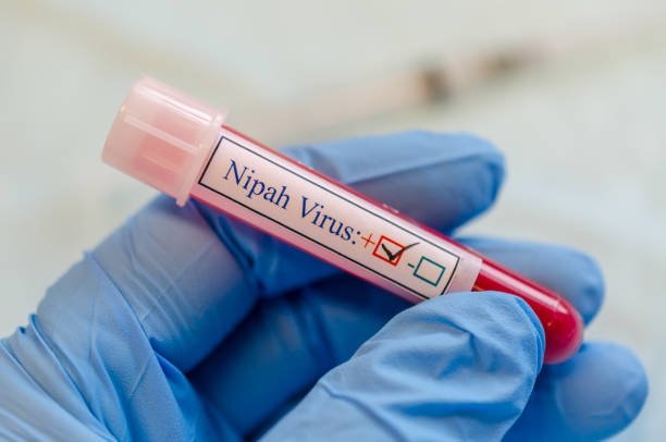 What is Nipah Virus? Symptoms, Spread, and Risk Explained 1 nipah virus