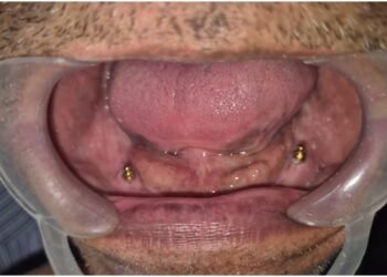 Teeth Care Multispeciality Dental Clinic