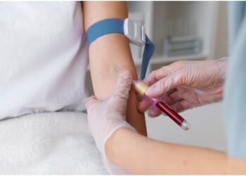 S Widal Test: Purpose, Procedure, and Typhoid Diagnosis Explained